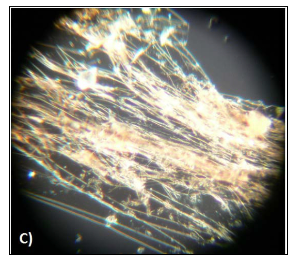 Fibre amiloidi preparate a partire da citocromo C in soluzione diluita. L'immagine è ottenuta con un microscopio polarizzatore con Nicol incrociati. 