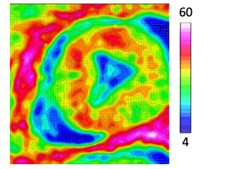 FPA-FTIR analysis of triple-negative breast cancer samples