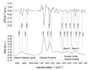 FPA-FTIR analysis of triple-negative breast cancer samples